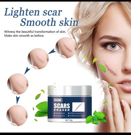 Creme SCARS