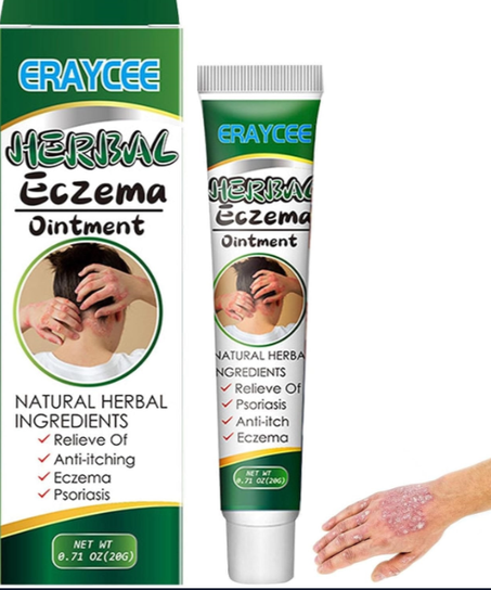 مرهم عشبي للأكزيما