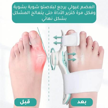 مصحح اعوجاج اصبع القدم القابل للتعديل / Correcteur de déformation des orteils ajustable