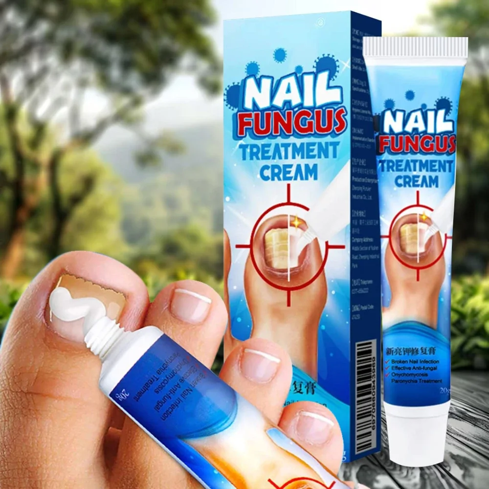 كريم علاج فطريات الأصابع