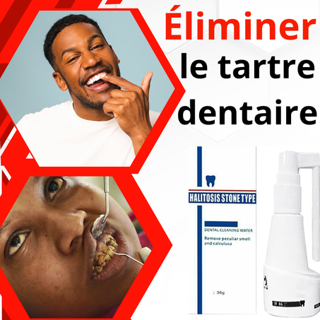 Vaporisateur oral puissant dissolvant le tartre ShinTeet