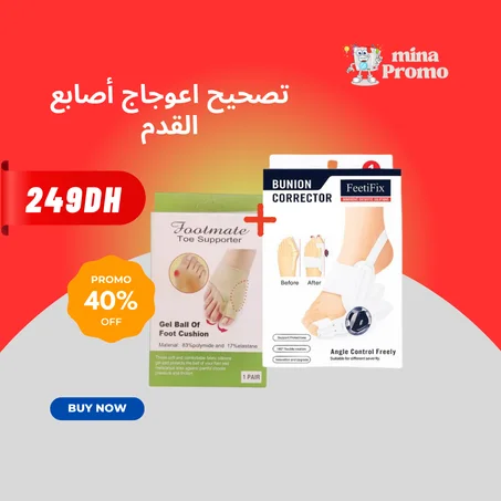 تصحيح اعوجاج أصابع القدم