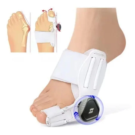 جهاز تصحيح اعوجاج أصابع القدم