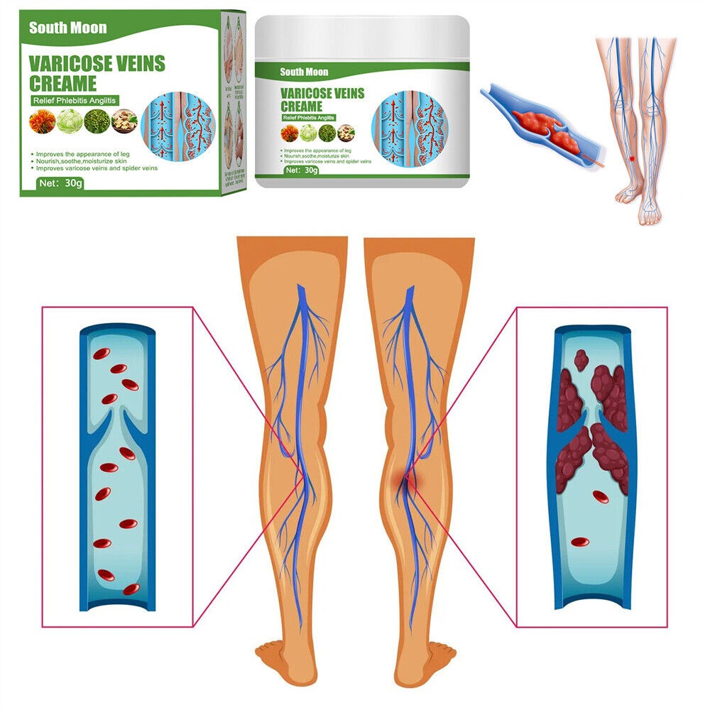 stores/4750f4b0a32183d5bcc64cc6e38bb0cb/products/QqX5X9yarn8pQXgVEs0PLR1FjOkY2fay93S6ByWW.jpeg