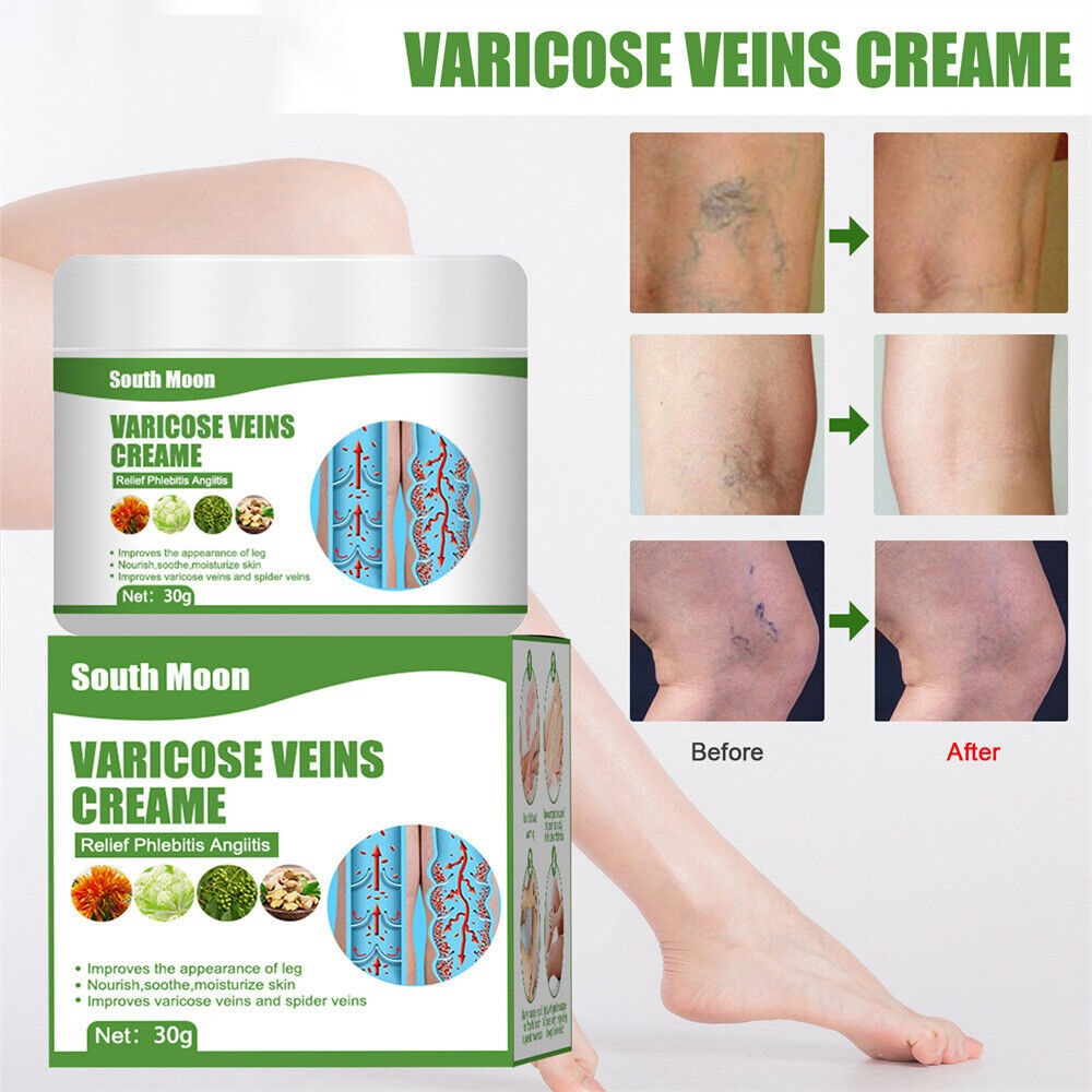 stores/4750f4b0a32183d5bcc64cc6e38bb0cb/products/hveGZyPtqWBgehkvAbZEygvBYSB95iY04r5vChL0.jpeg