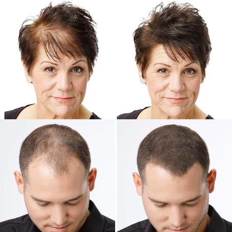 Toppik - الحل الرائع لخسارة الشعر وتساقطه