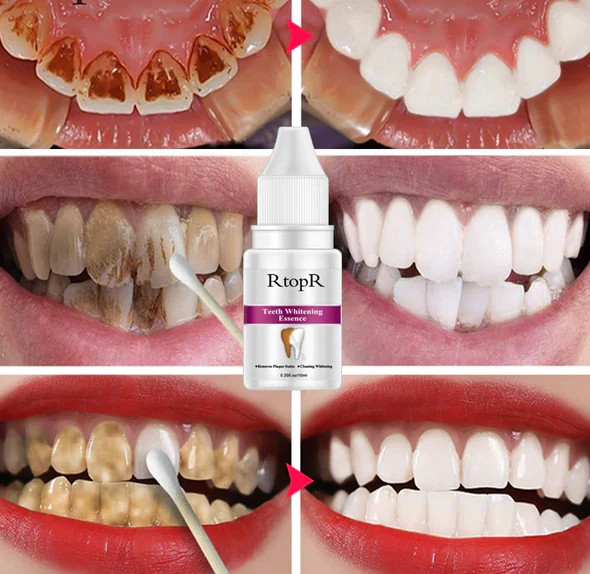 جوهر تبييض الأسنان!