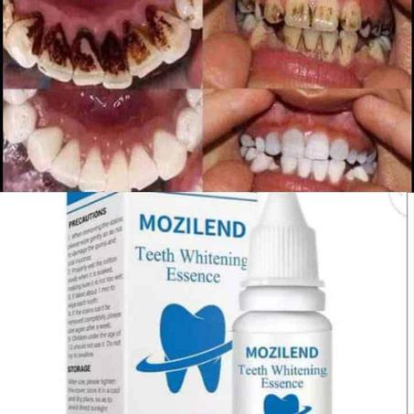 جوهر تبييض الأسنان!