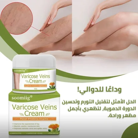 كريم علاج الدوالي