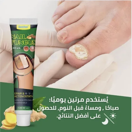 كريم الزنجبيل للأظافر