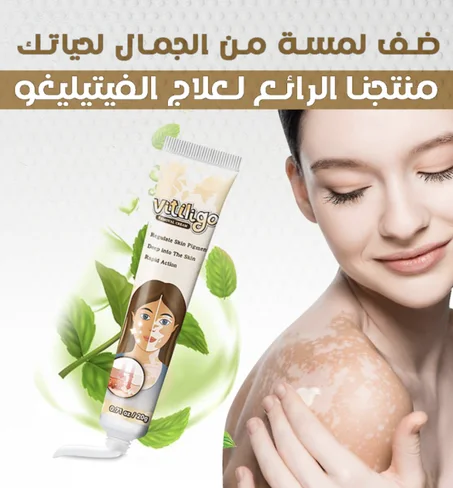 كريم فيتيليغو لعلاج البهاغ