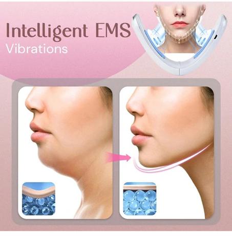 Dispositif médical de réduction du double menton