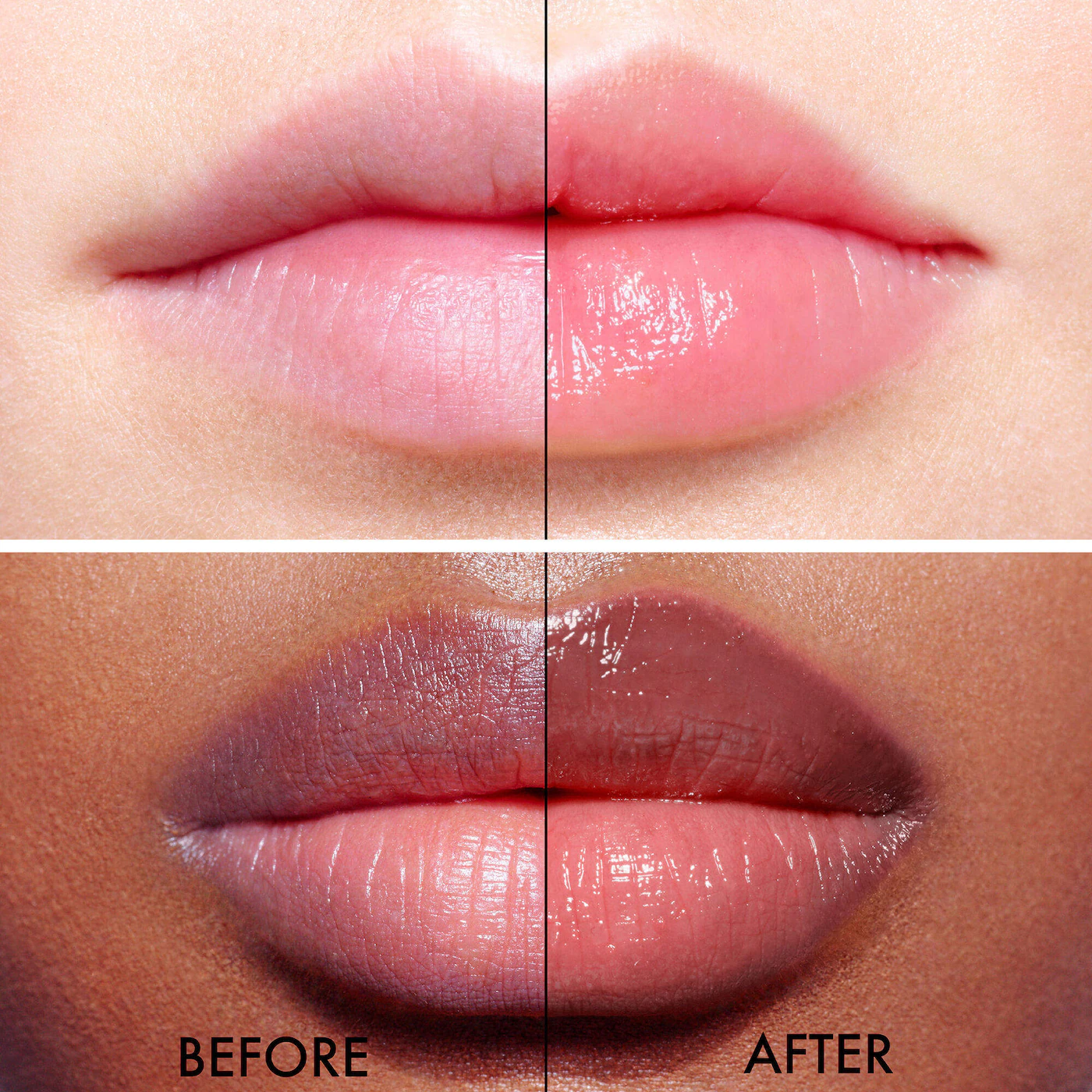 الشنطة التريند - طقم كامل مع (ليب جلو + ليب ماكسمايزر )