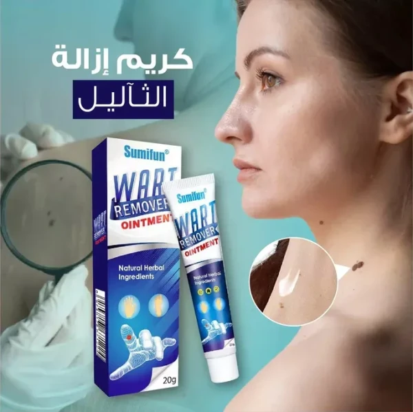 كريم ازالة الثئاليل