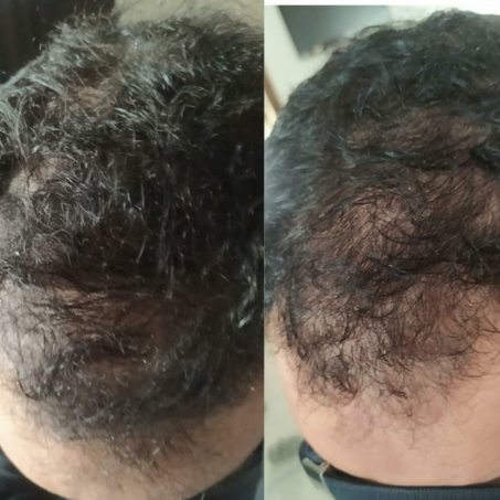 العناية بالشعر