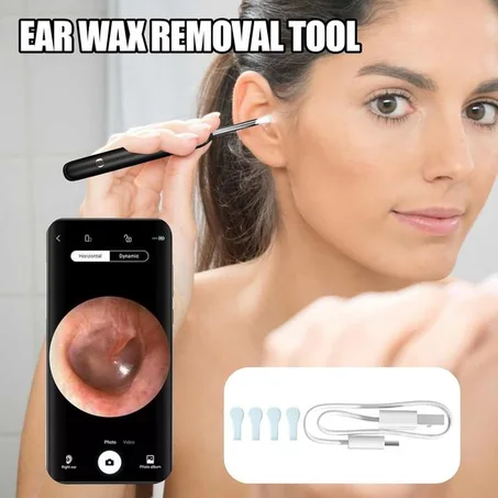 Nettoyeur d'oreilles avec camera HD