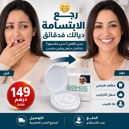 Snap-On Smile ab  - Facebook