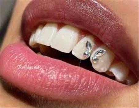 مجموعة مجوهرات أسنان فراشة خالية من الرصاص بأشكال وألوان مختلفة من أحجار الكريستال متعددة الأغراض للعناية بصحة الفم