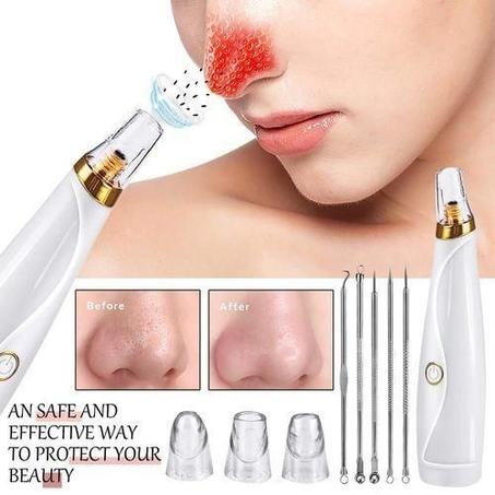 Extracteur De Points Noirs, Extracteur De Boutons Sous Vide, Kit D'aiguilles Pour Points Noirs