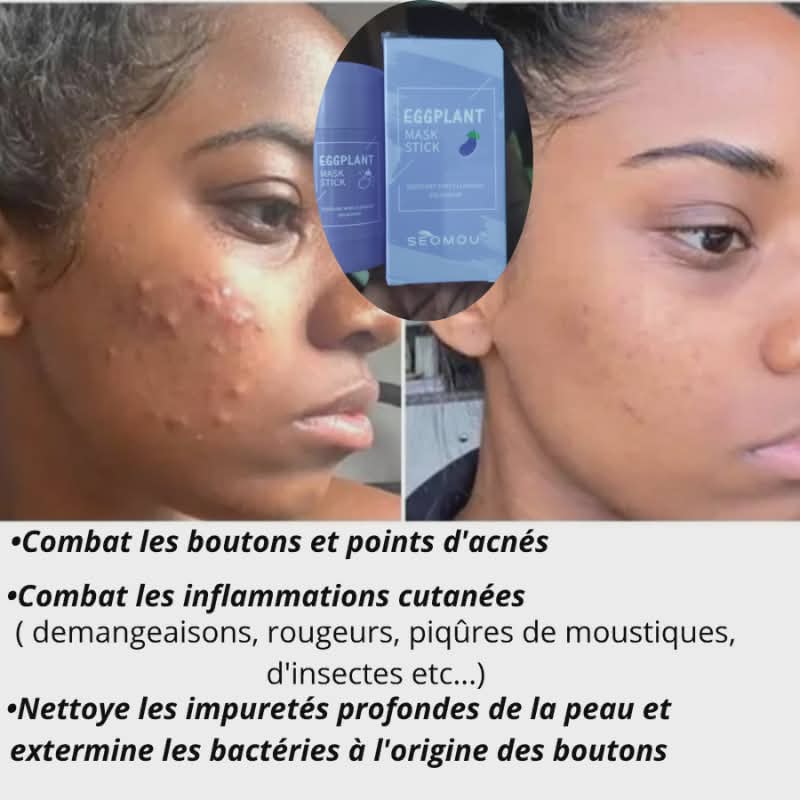 Masque Soin de Visage