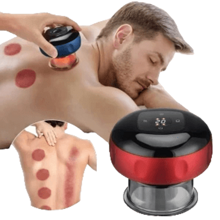 مجموعة العلاج بالحجامة الكهربائية - 6 أوضاع Electric Cupping Therapy Set - 6 modes