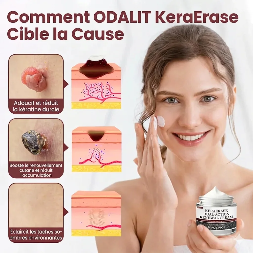 🌟KERAERASE DUAL ACTION  – Crème Régénérante Intense