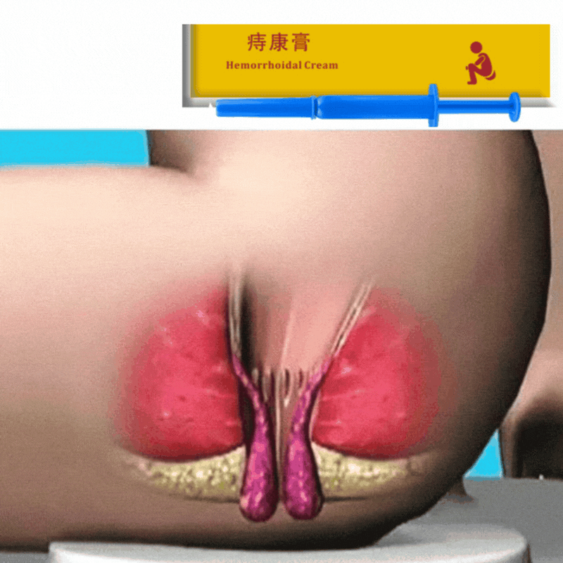 HemoRelief™ – La crème apaisante conçue pour retrouver confort et sérénité au quotidien.