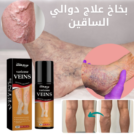 بخاخ علاج دوالي الساقين