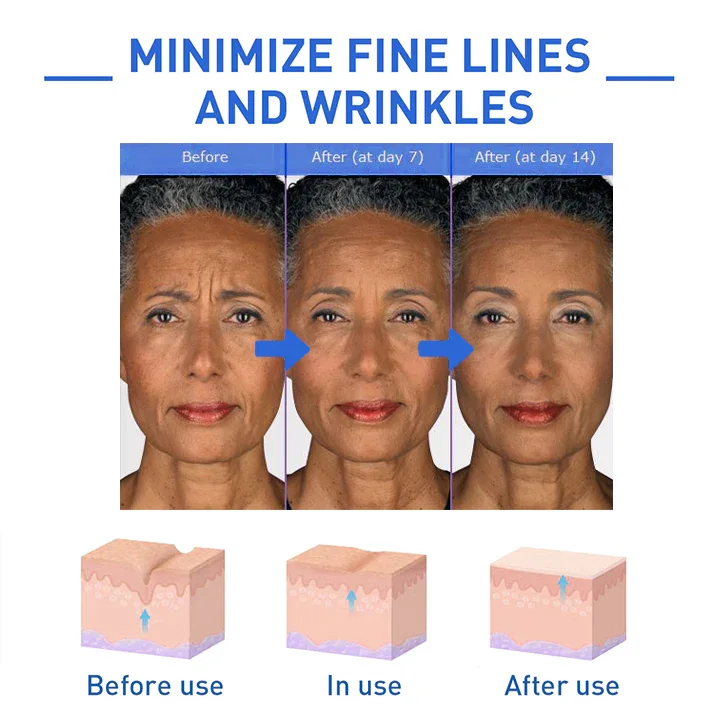 Botox  سيروم الوجه الكولاجين المضاد للشيخوخة، لجميع أنواع البشرة