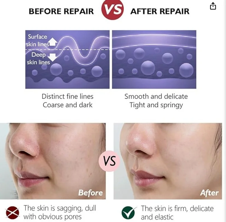 • Retinol cream (Anti-Aging)