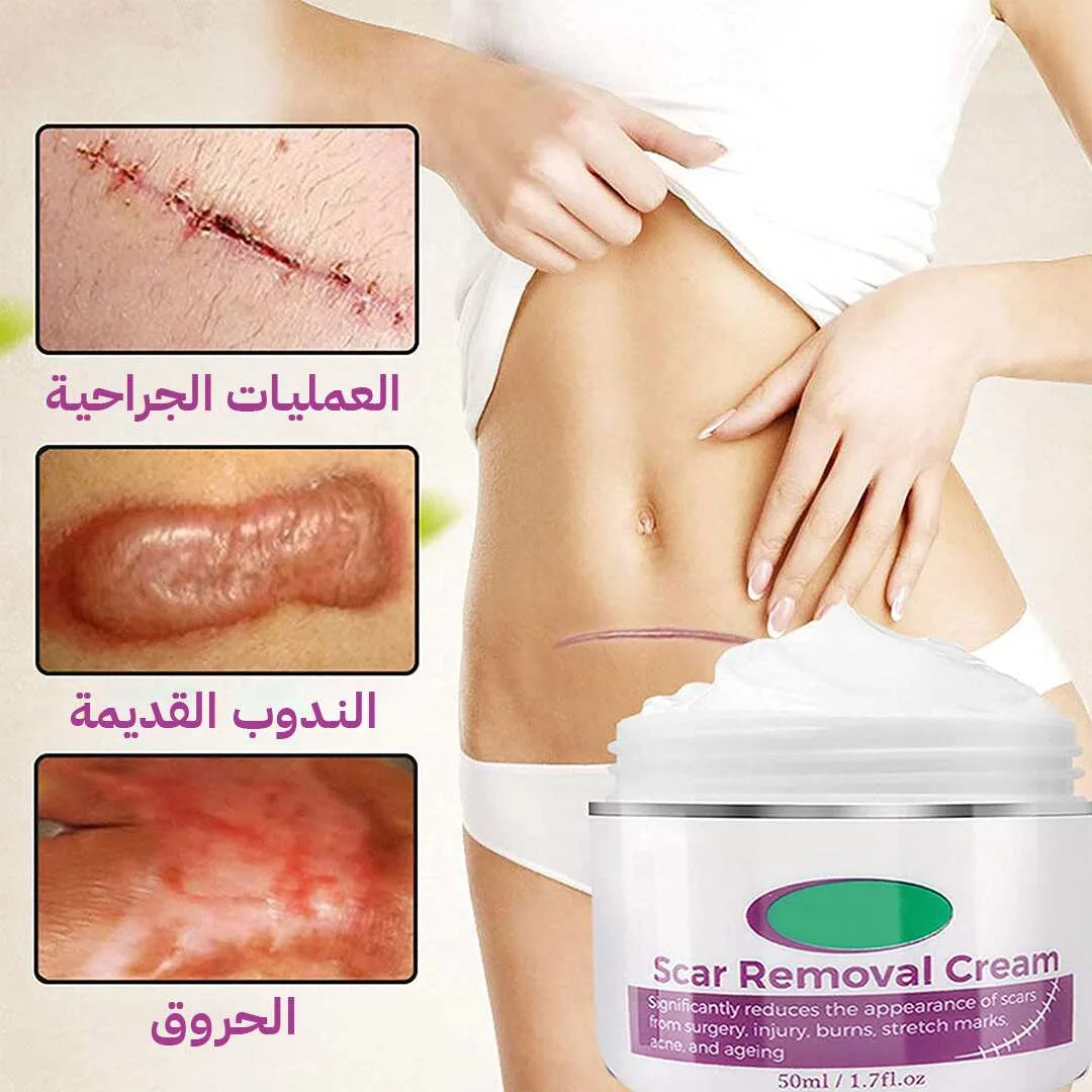 كريم إزالة الندبات السحري