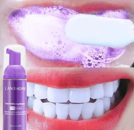 رغوة تبييض الأسنان