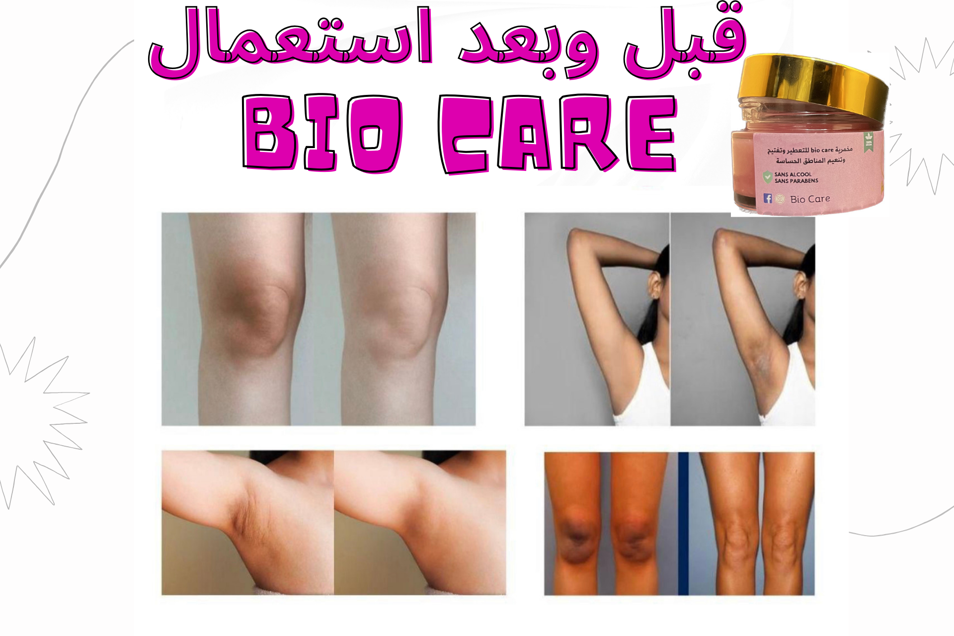 مخمريه زبده الشيا