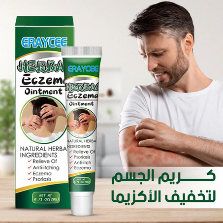 مرهم عشبي للأكزيما