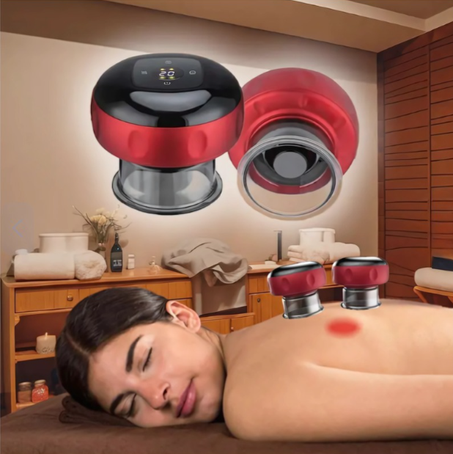 كؤوس الحجامة الكهربائية