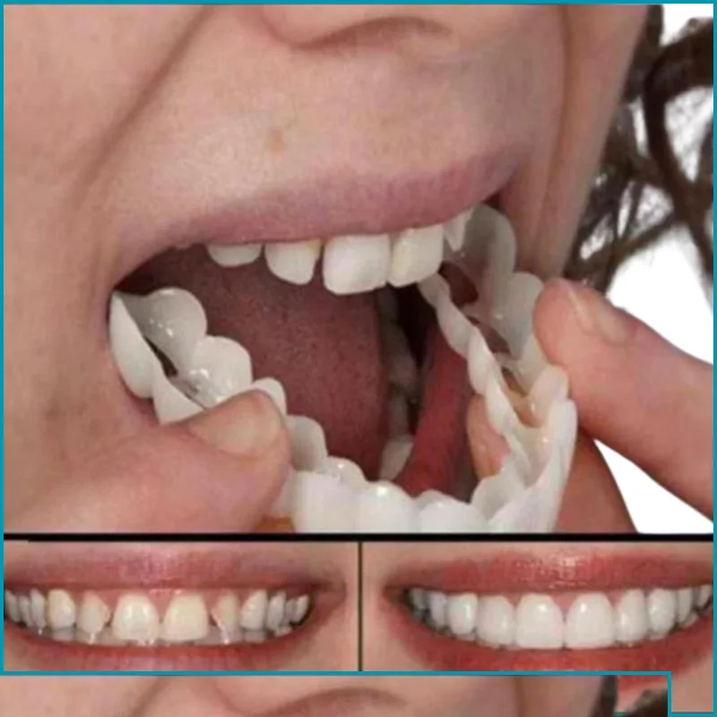 غشاء تبييض الأسنان العلوي