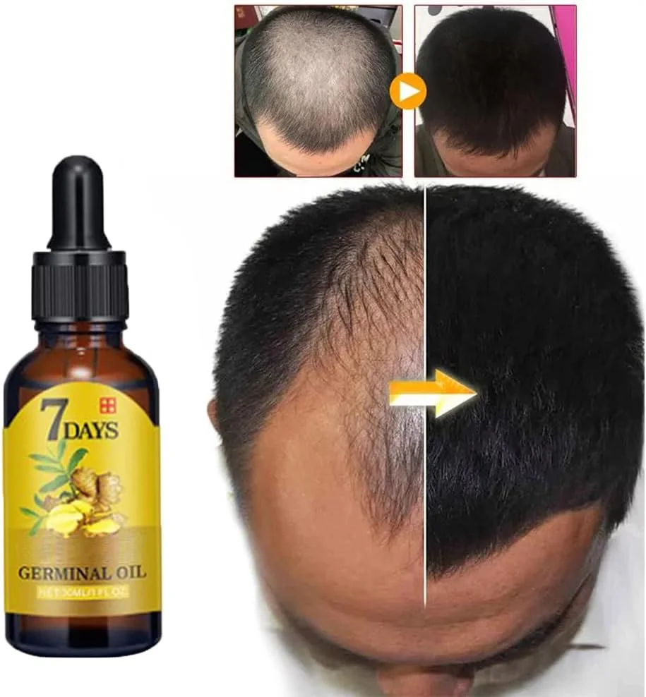 زيت الزنجبيل لنمو الشعر