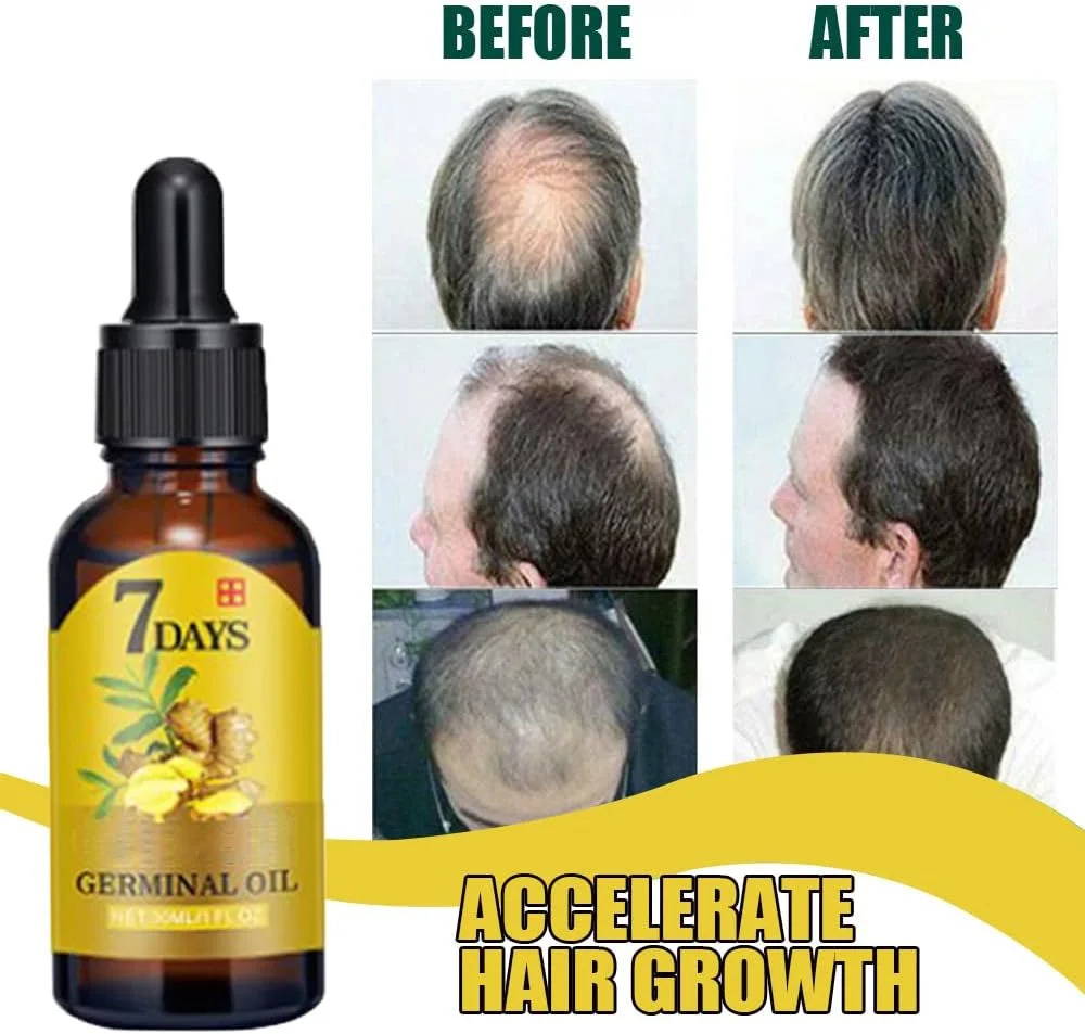 زيت الزنجبيل لنمو الشعر