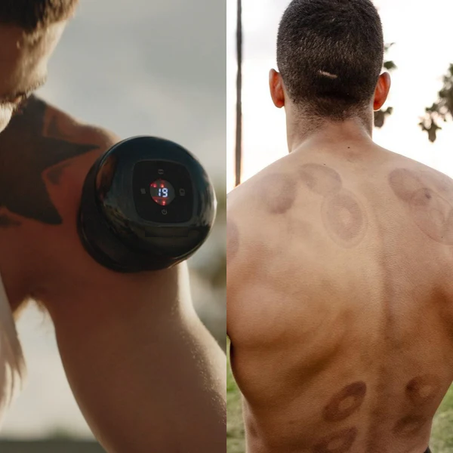 Appareil de Massage Intelligent par Ventouses