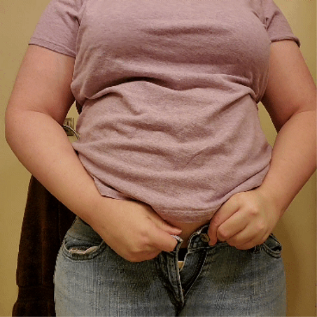 حزام شد البطن