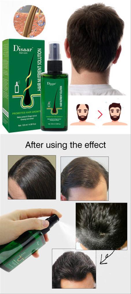 أنقد شعرك من الصلع قبل فوات الأوان