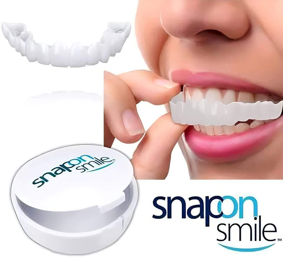 تركيبة أسنان هوليود سمايل Snapon smile