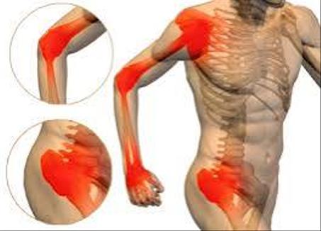 روماكريم ـ دهن الروماتيزم لعلاج الروماتيزم وأوجاع المفاصل وبرودة المفاصل