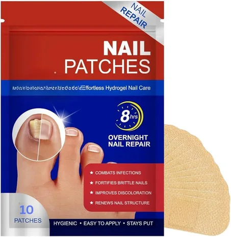 علاج الفطريات