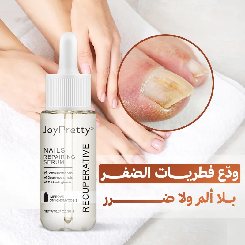 💥 سيروم علاج فطريات الأظافر