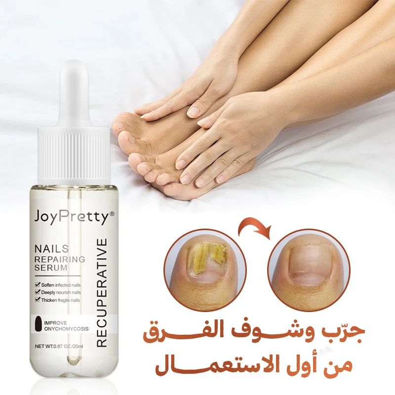 💥 سيروم علاج فطريات الأظافر