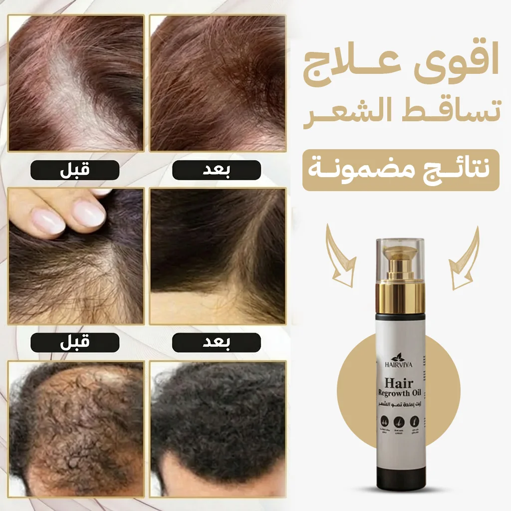 زيت علاج تساقط الشعر للرجال والنساء