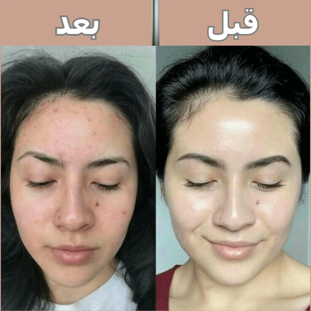 Oberlingo-Sérum éclaircissant pour le visage