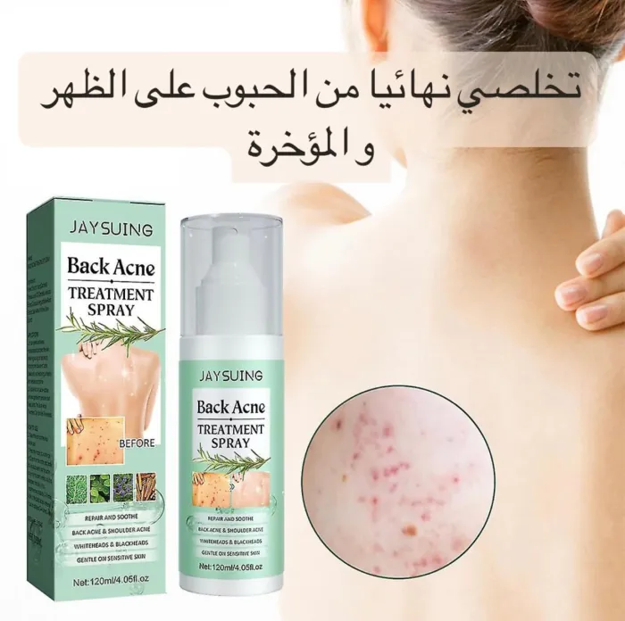 حلّ النهائي لمشاكل الحبوب
