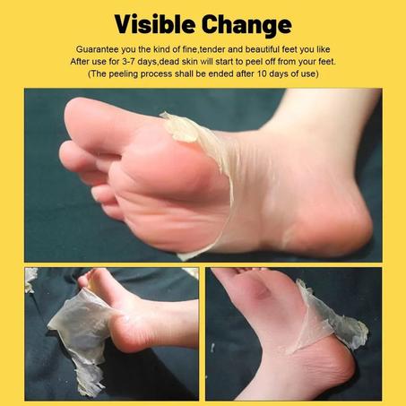 Foot Pealing Mask مقشر الأرجل